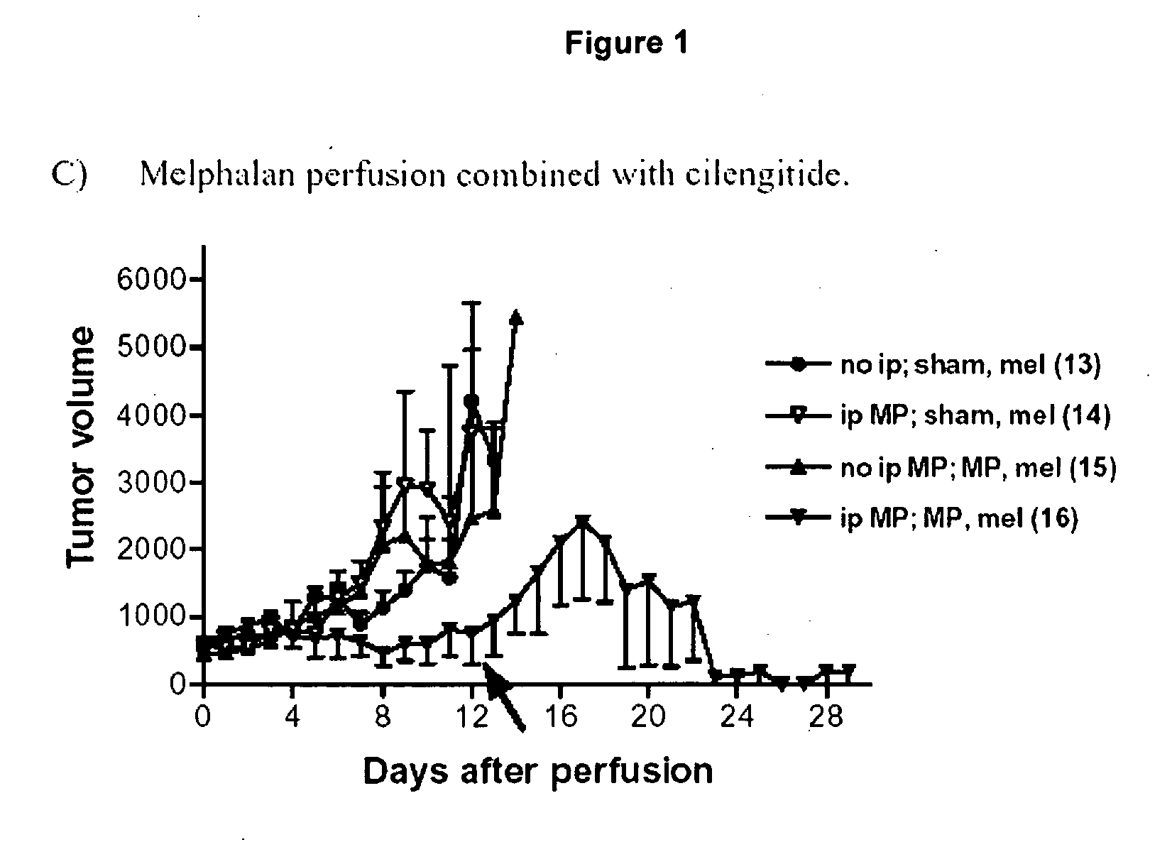 Isolated organ perfusion combination therapy of cancer