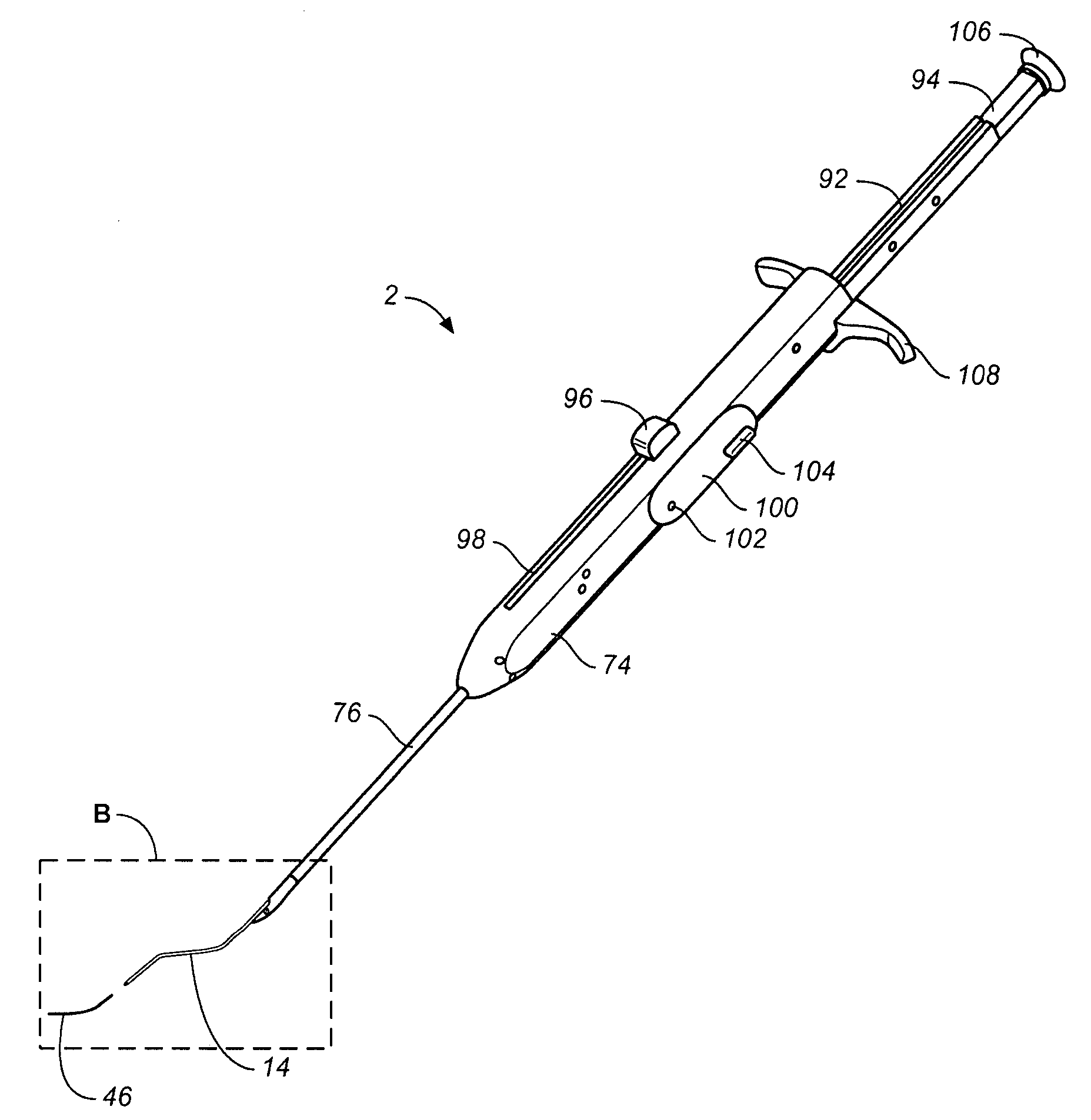 Access and closure device and method