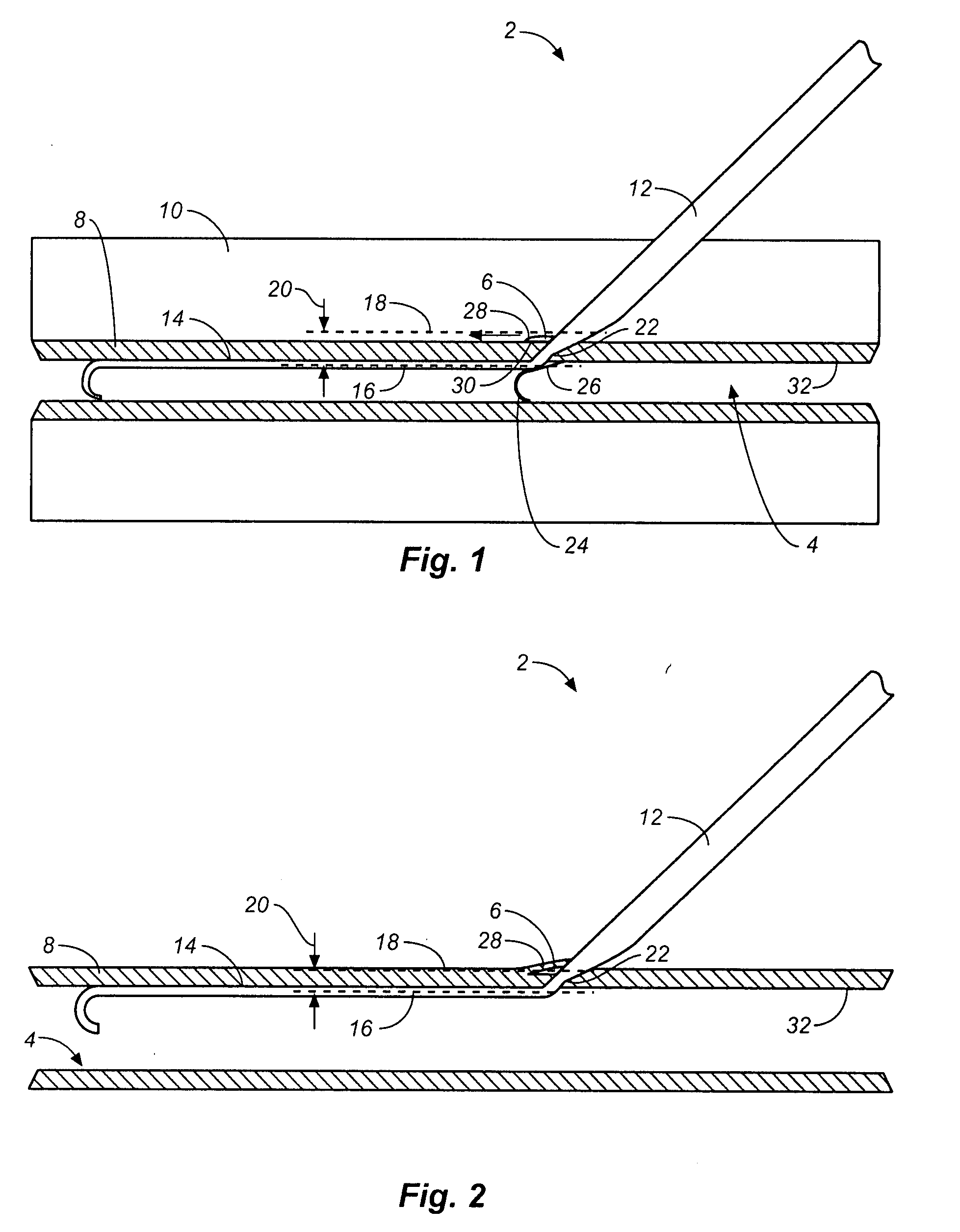 Access and closure device and method