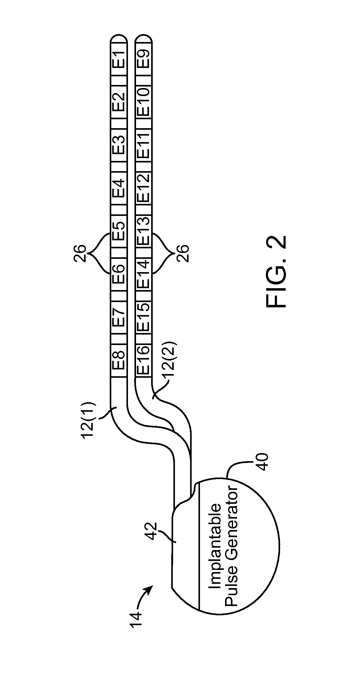 Neurostimulation system with default mri-mode