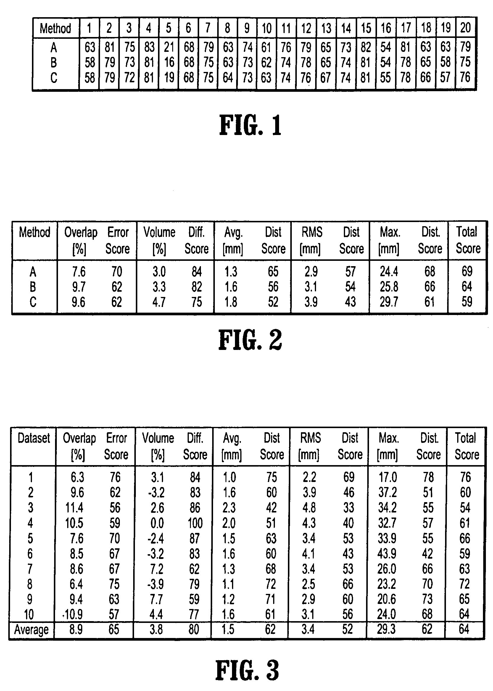 System and method for global-to-local shape matching for automatic liver segmentation in medical imaging