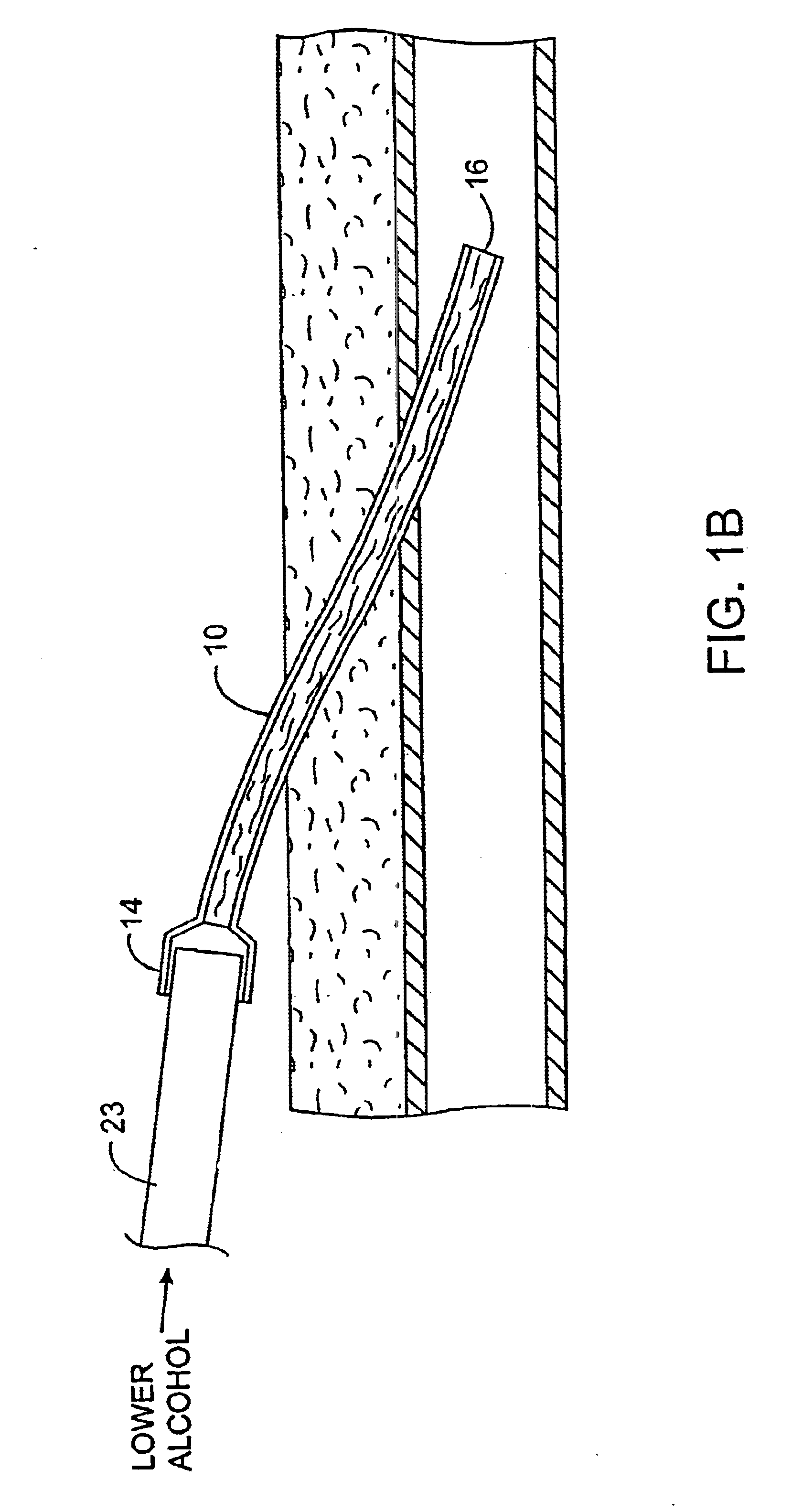 Methods and kits for locking and disinfecting implanted catheters