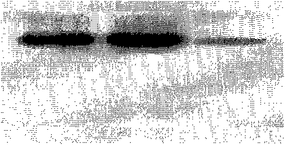 Gd-DTPA-Polylysine-McAb junctional complex, preparation method and application thereof