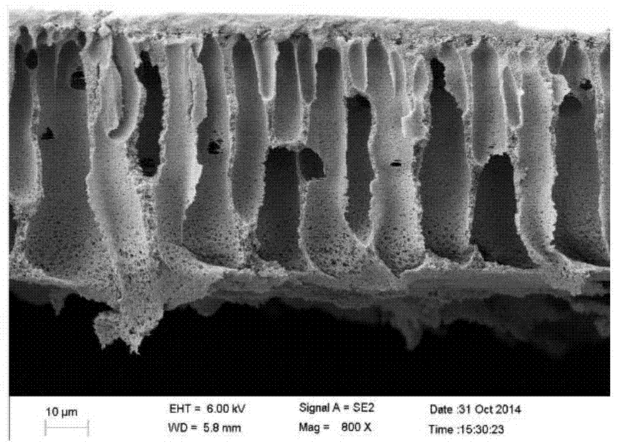 Anti-pollution and high-flux ultrafiltration membrane, preparation method thereof and membrane casting solution