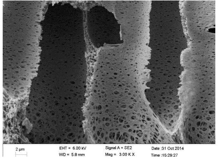 Anti-pollution and high-flux ultrafiltration membrane, preparation method thereof and membrane casting solution