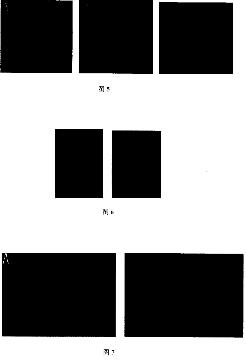 Adeno-associated virus vector preparation and medicinal composition containing it and its use