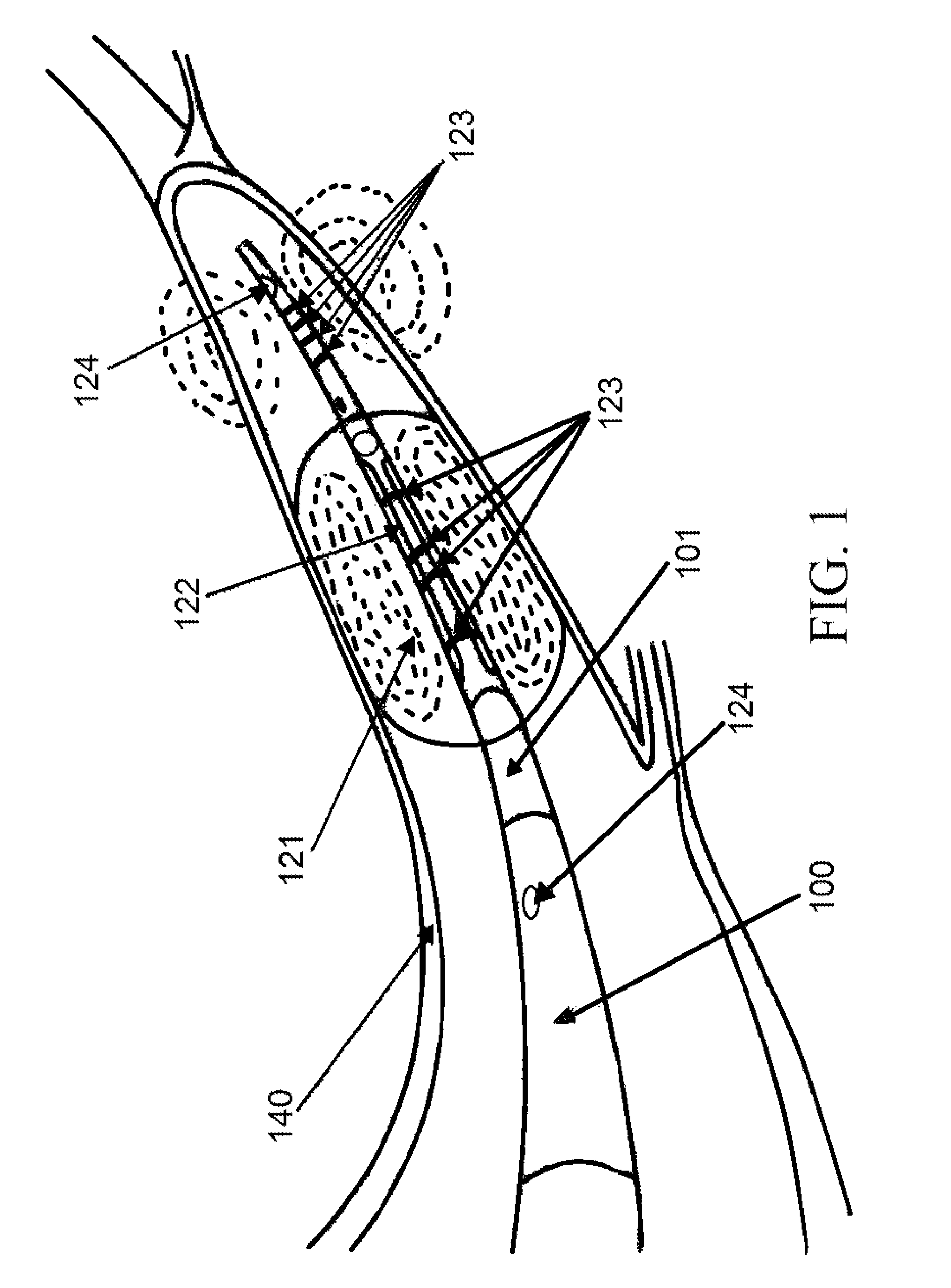 Device and methods for controlling blood perfusion pressure using a retrograde cannula