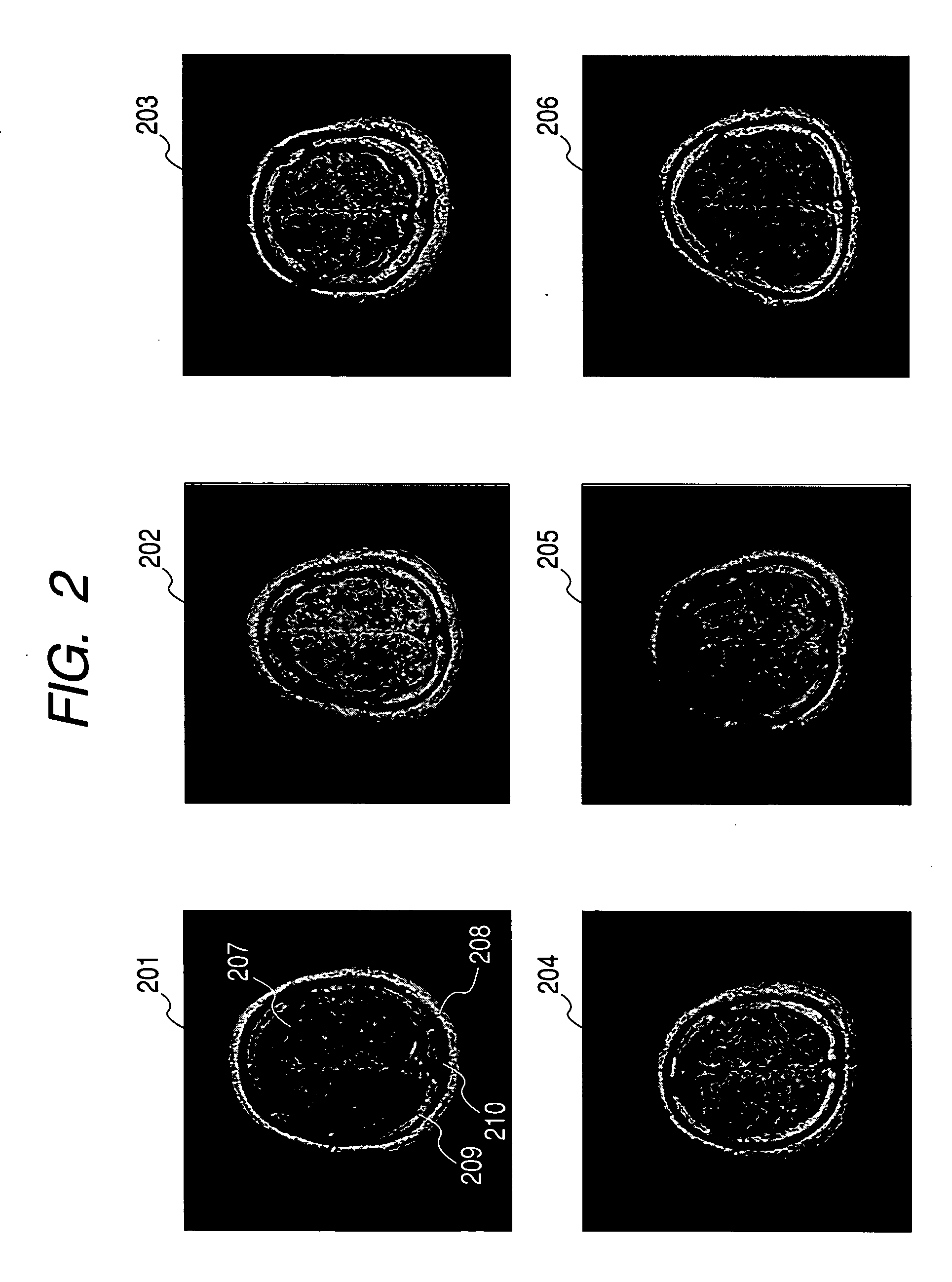 Inspection apparatus using magnetic resonance