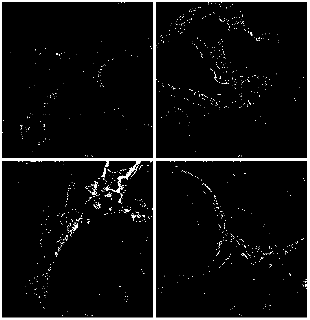 Application of dendrophenol in preparing medicines for preventing and treating chronic glomerular disease