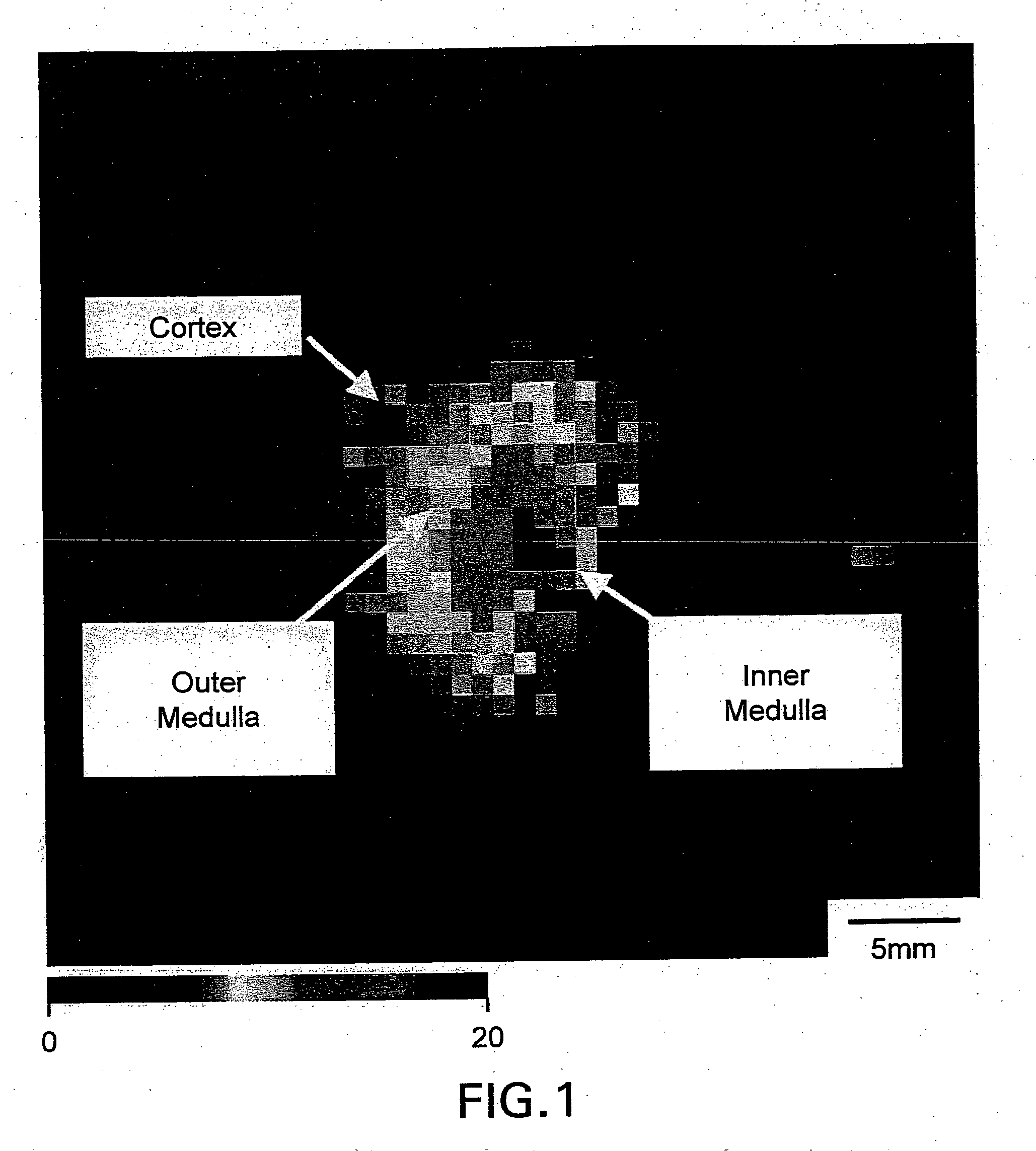 Method and apparatus for quantitatively evaluating a kidney