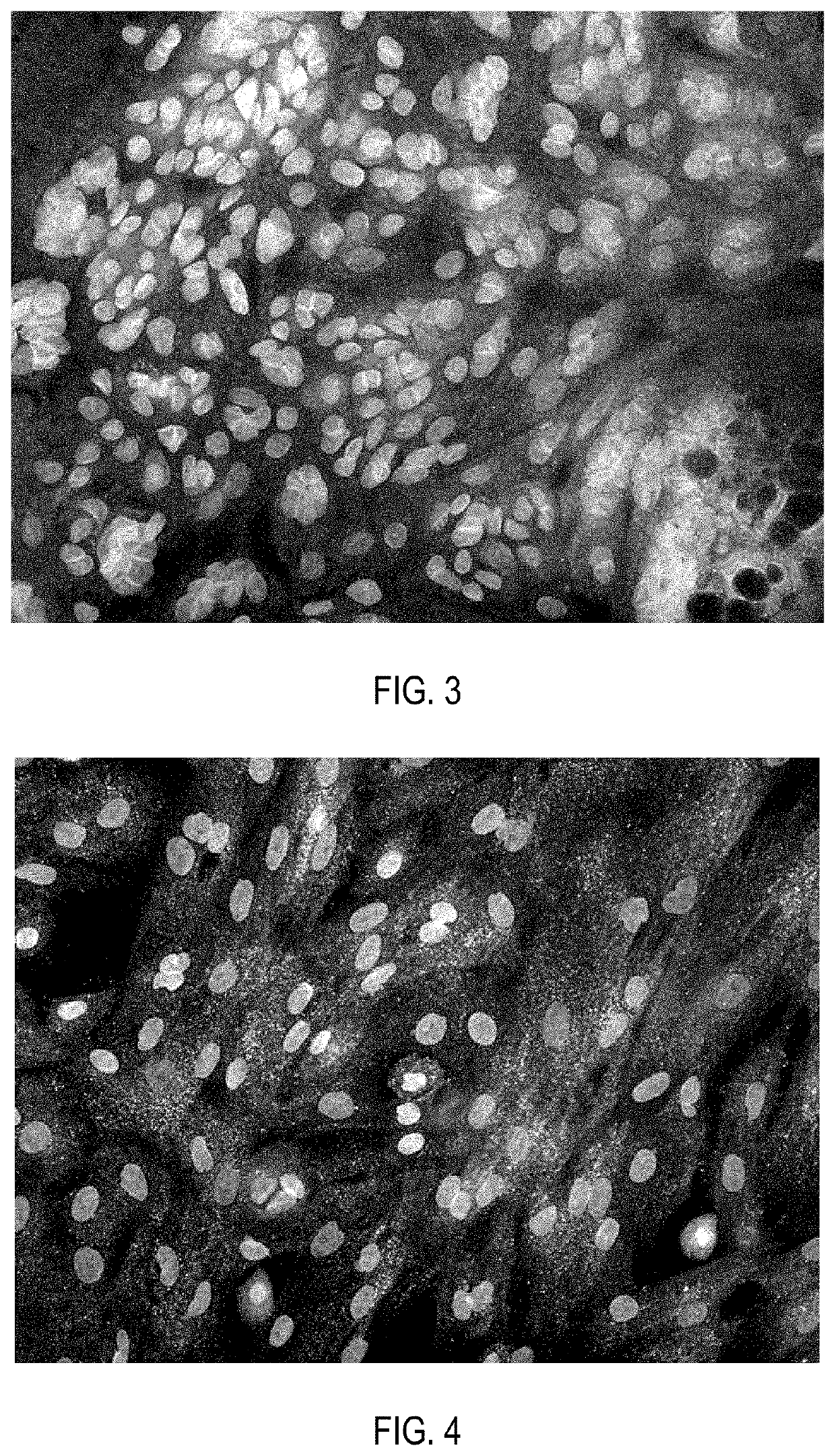 Cell product of mammalian insulin-producing cells and methods for using the same