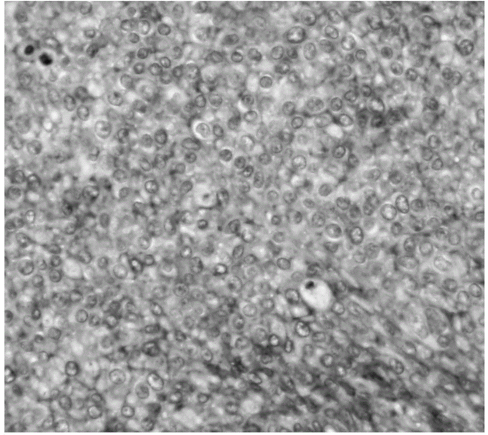 Human urothelial carcinoma specific antibody and its application