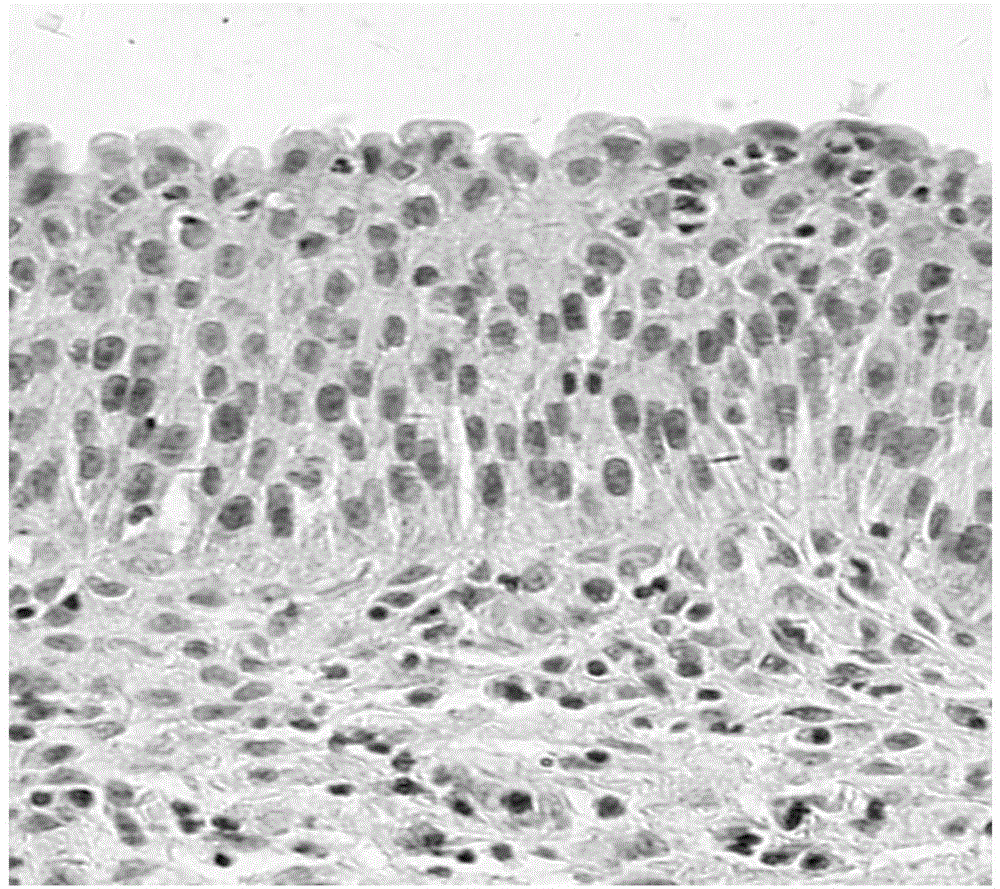 Human urothelial carcinoma specific antibody and its application