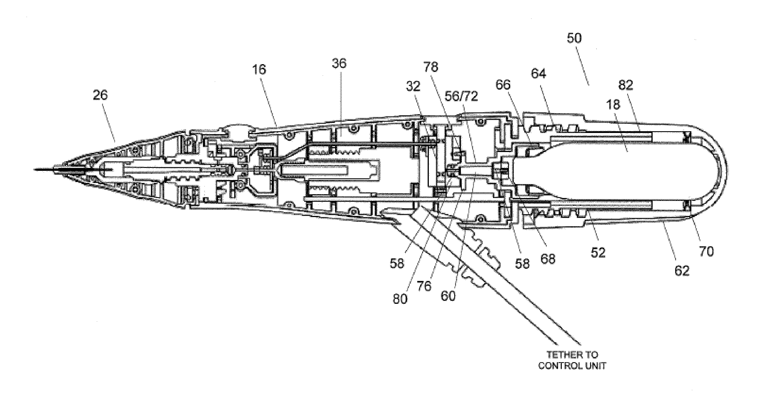 Methods and Systems for Treatment of Spasticity