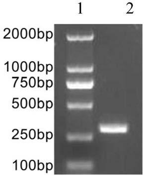 Kit for detecting mutation of pathogenic gene KCNQ4 of non-syndromic autosomal dominant hereditary deafness