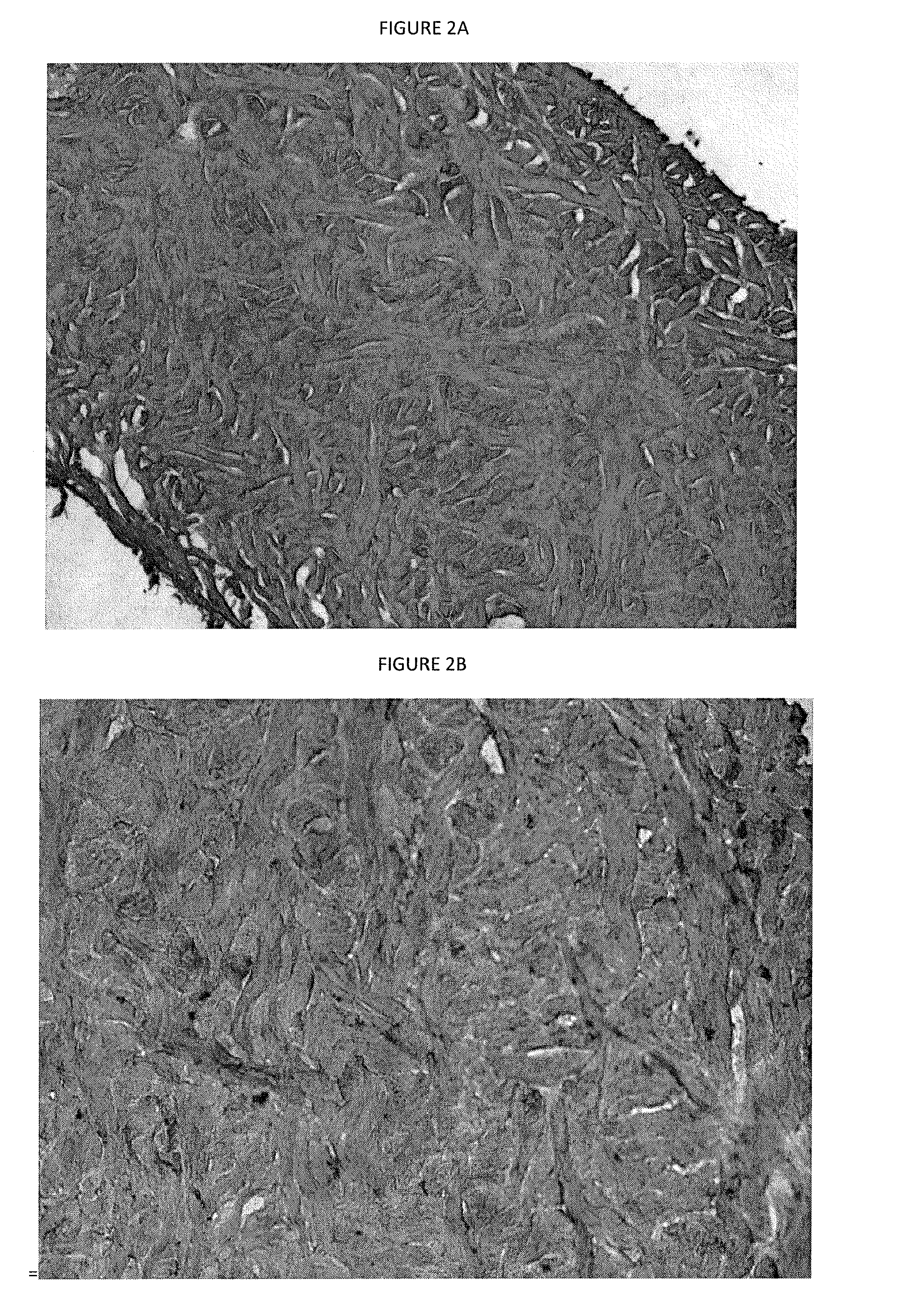 Xenograft soft tissue implants and methods of making