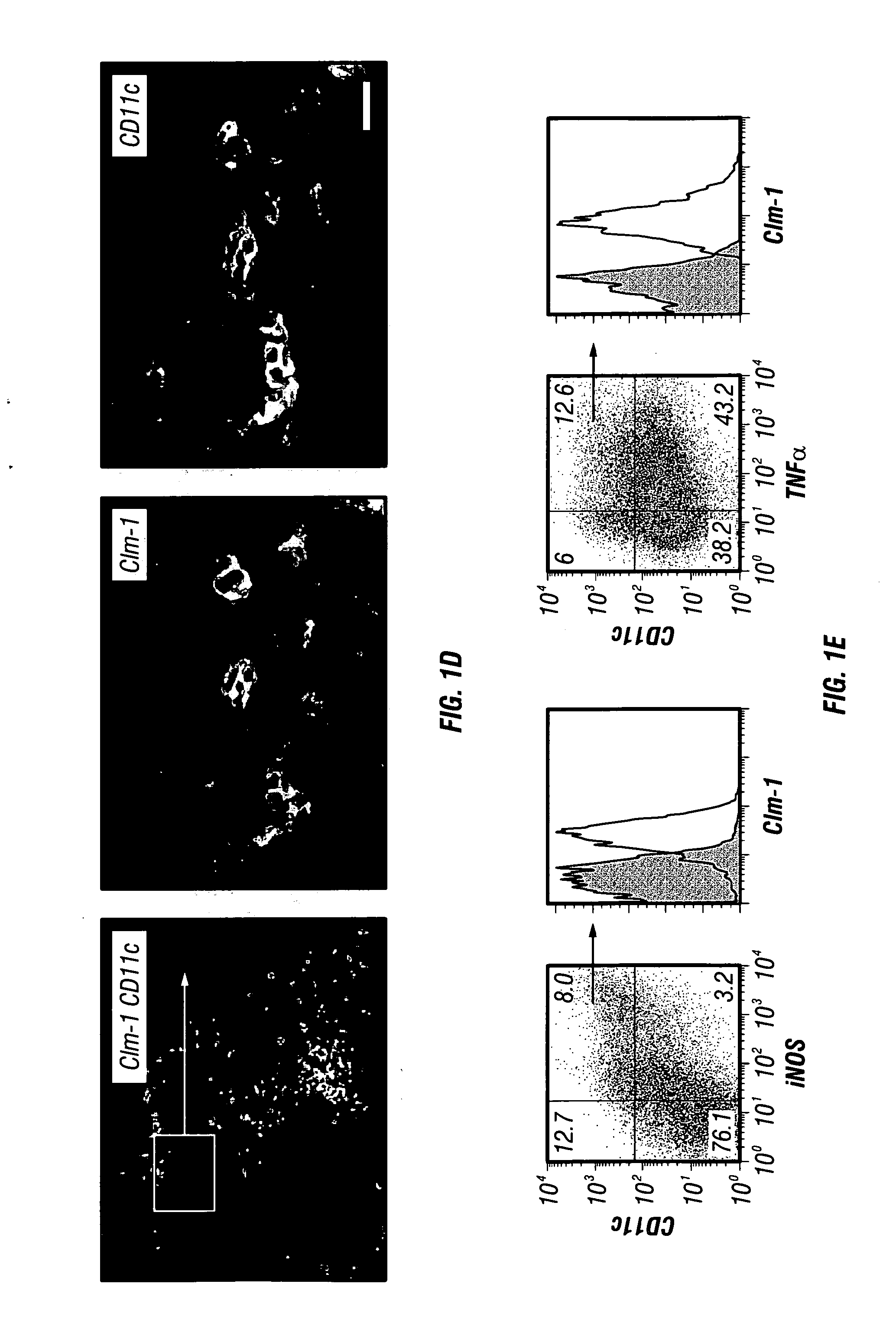 Diagnosis and treatment of autoimmune demyelinating diseases