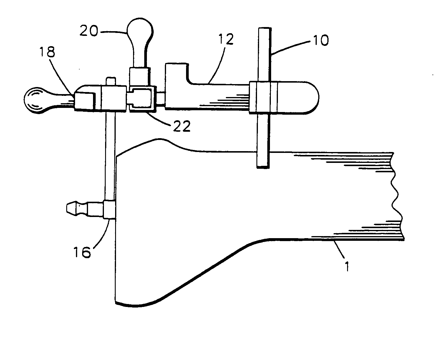 Methods and tools for femoral resection in knee surgery