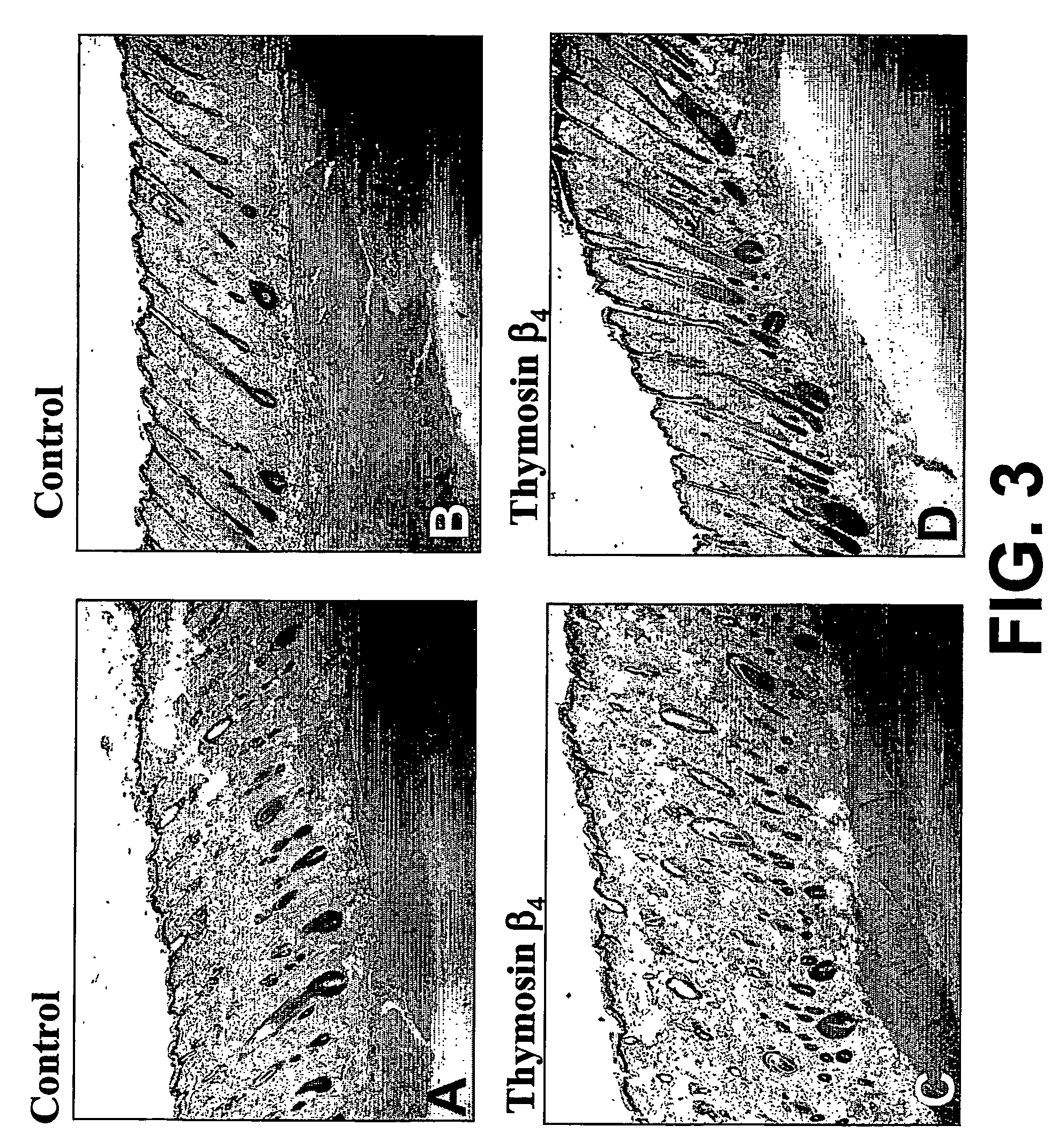 Methods and compositions for the promotion of a hair growth utilizing actin binding peptides