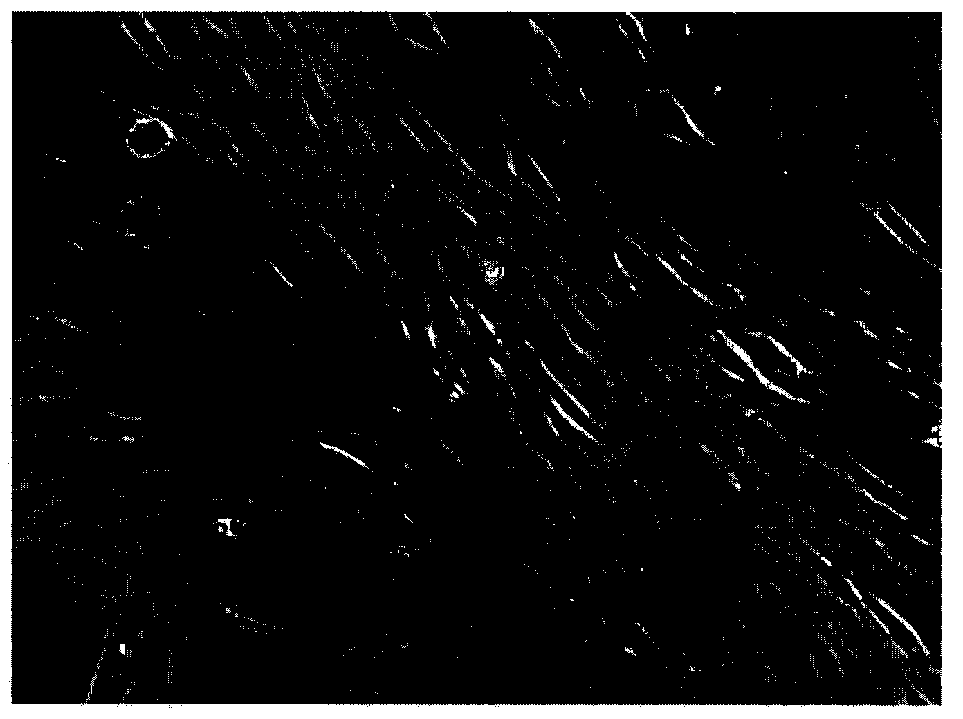 Preparation method of human adipose-derived MSCs (mesenchymal stem cells) and application of human adipose-derived mesenchymal stem cell in preparation of medicine for treating diseases