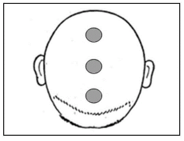 Traditional Chinese medicine composition and application, preparation method and product thereof