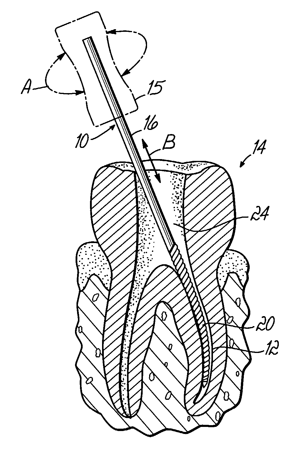 Endodontic instrument