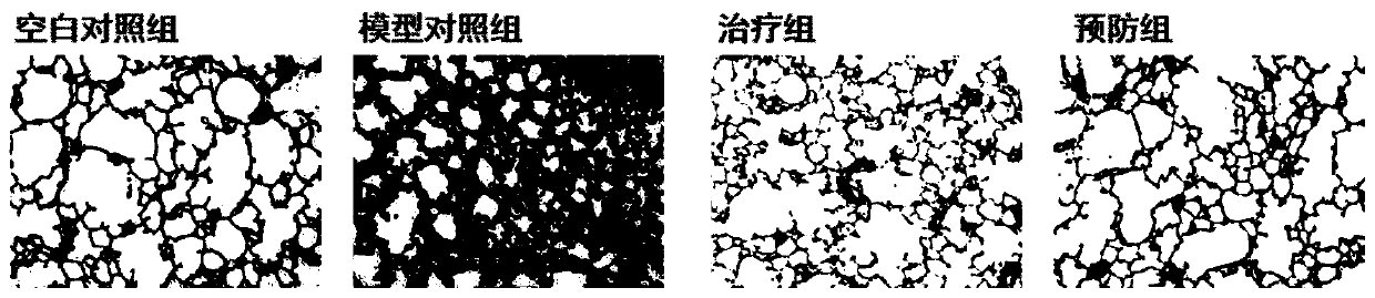 Imidazolopyrimidine derivatives for preventing and treating pulmonary fibrosis and application of imidazolopyrimidine derivatives