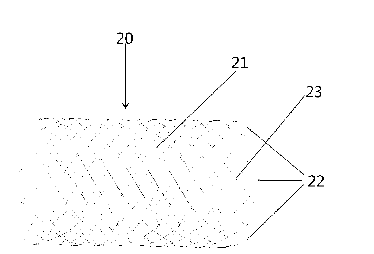 Prosthetic system for treating nasosinusitis or allergic rhinitis