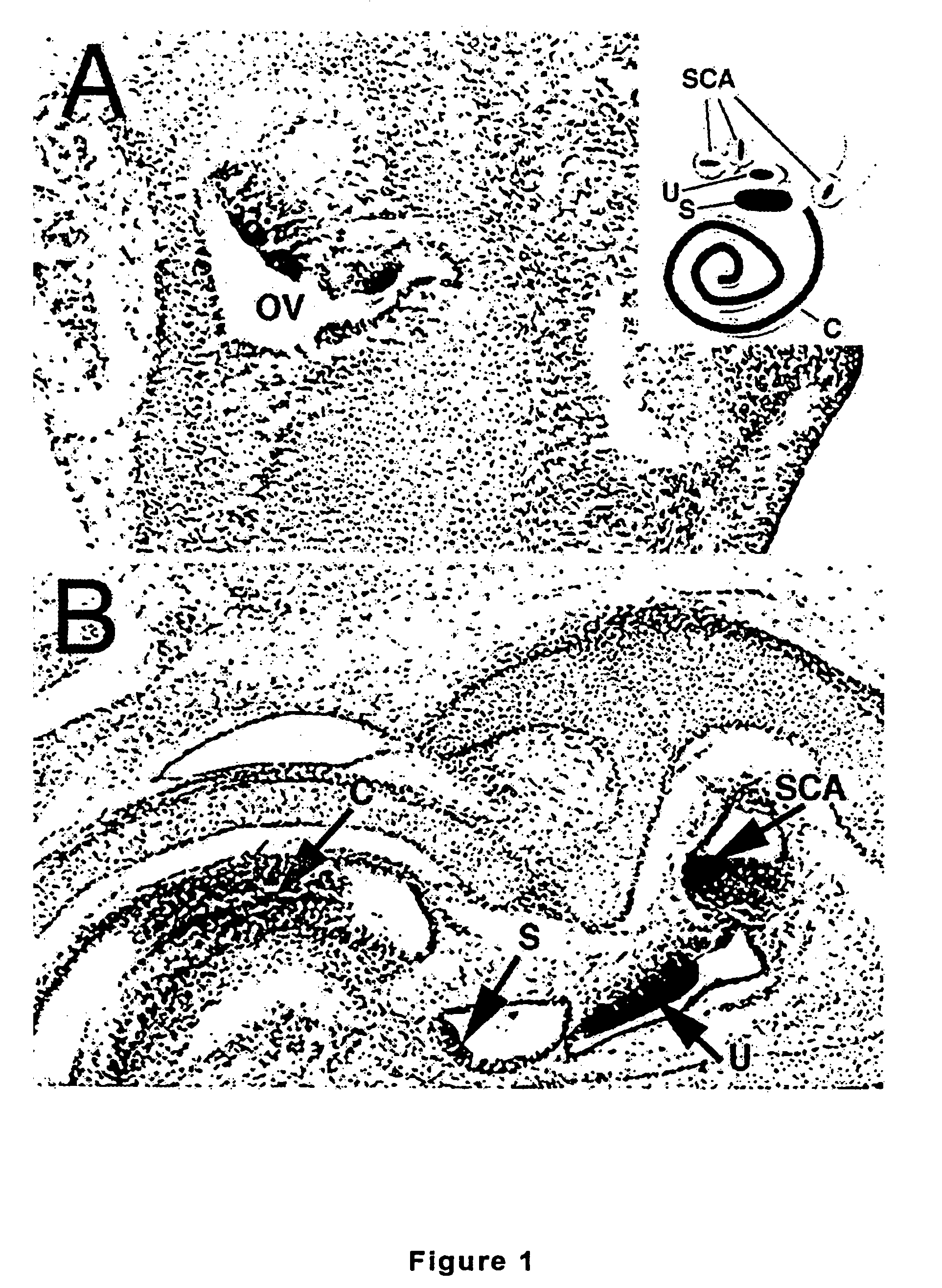 Composition and methods for the therapeutic use of an atonal-associated sequence for deafness, osteoarthritis and abnormal cell proliferation