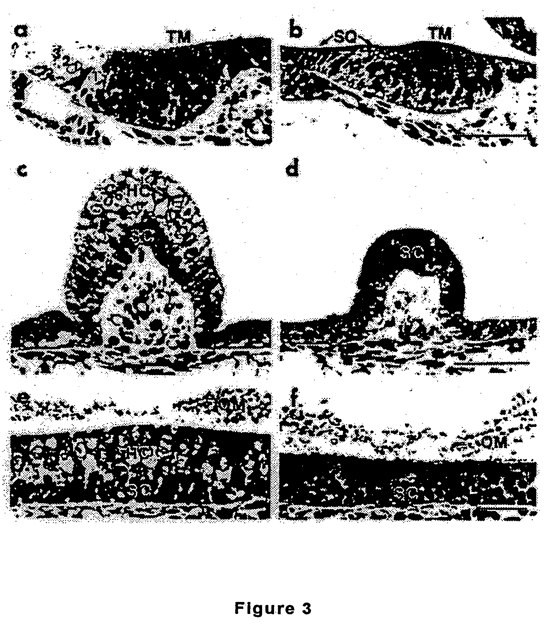 Composition and methods for the therapeutic use of an atonal-associated sequence for deafness, osteoarthritis and abnormal cell proliferation