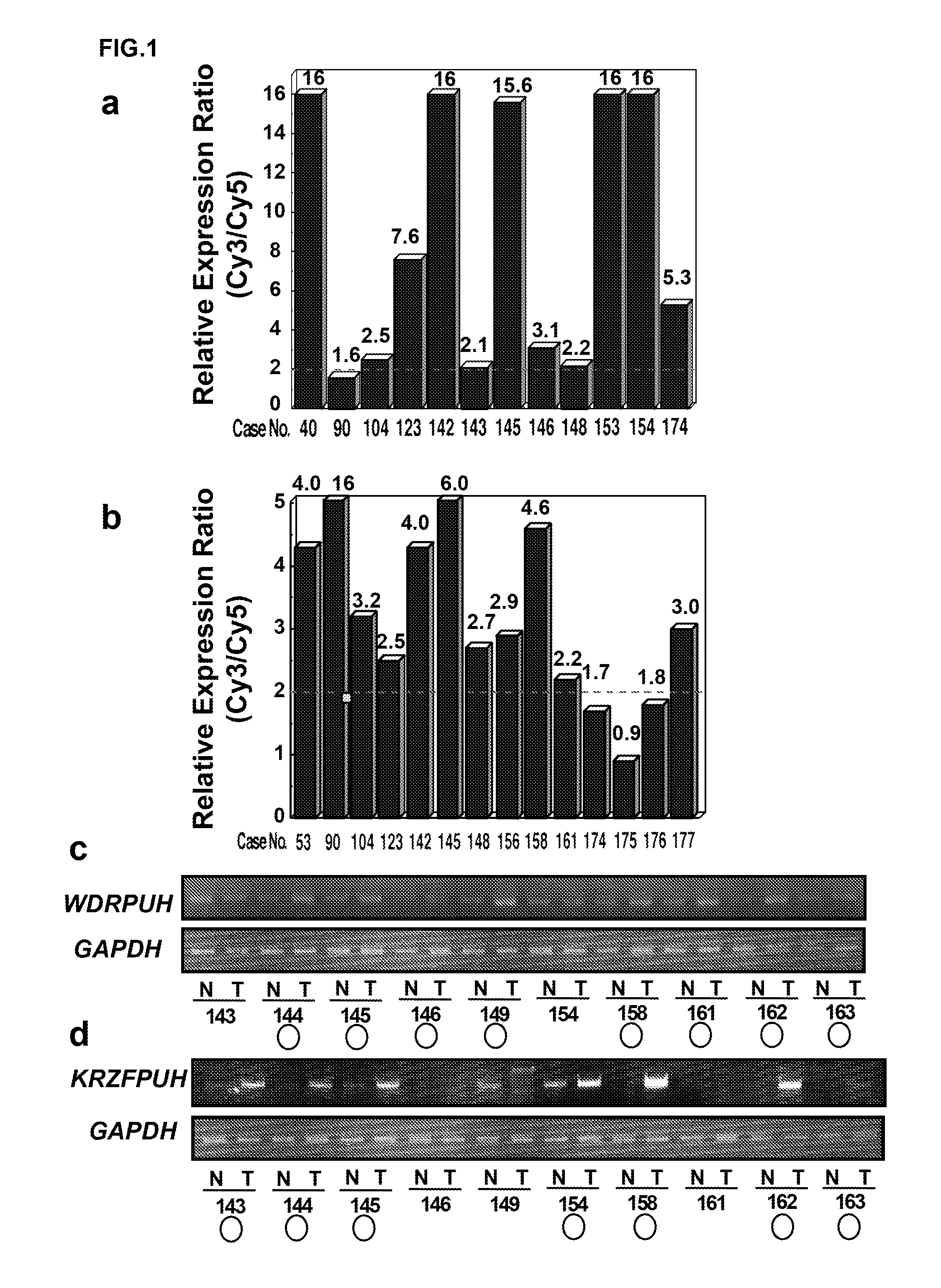 Genes and polypeptides relating to hepatocellular or colorectal carcinoma