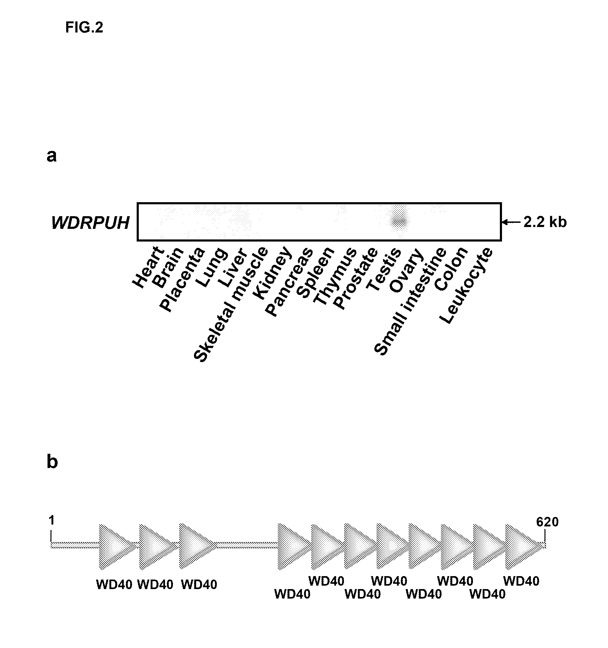 Genes and polypeptides relating to hepatocellular or colorectal carcinoma