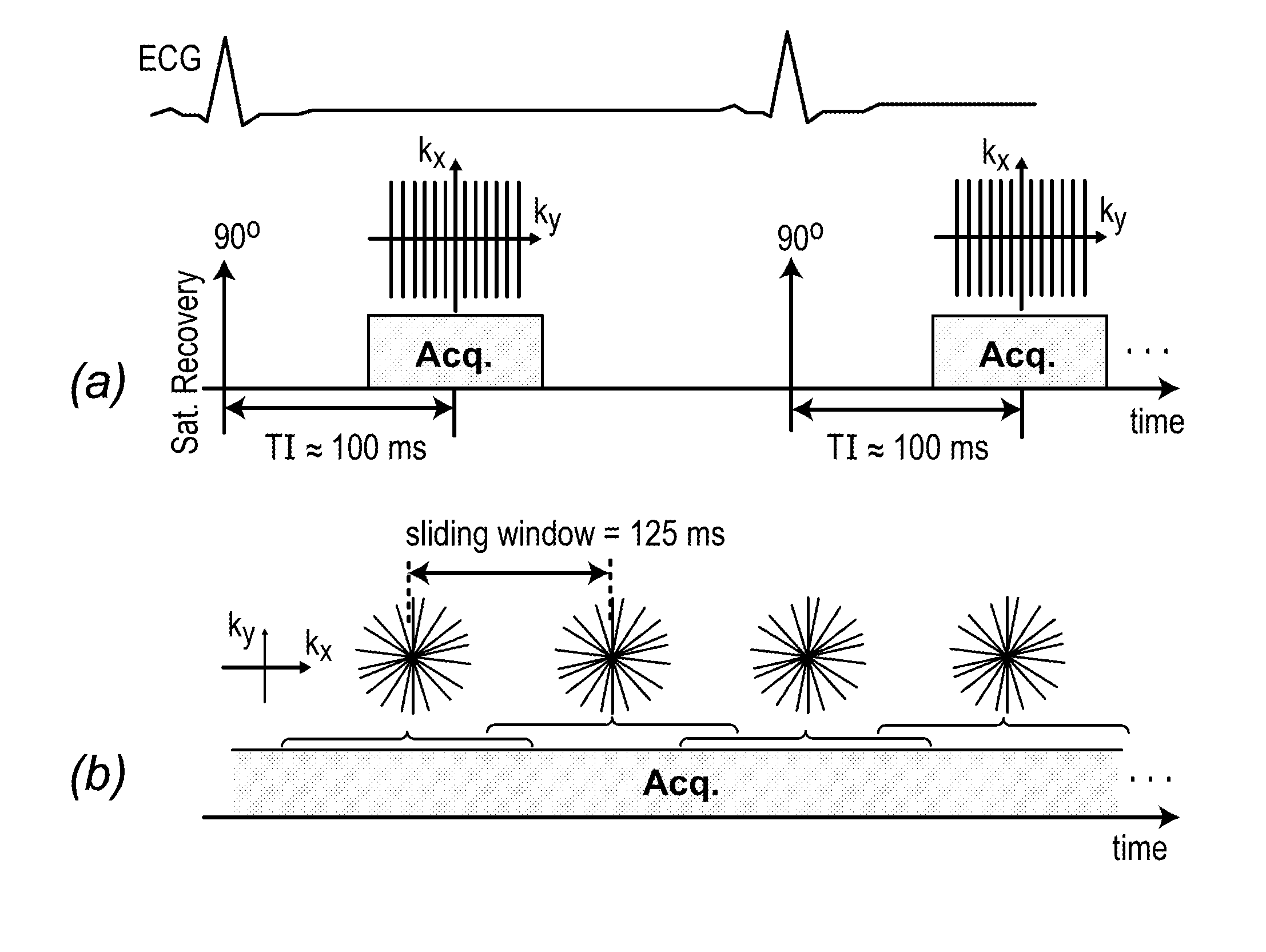 Systems and methods for myocardial perfusion MRI without the need for ECG gating and additional systems and methods for improved cardiac imaging