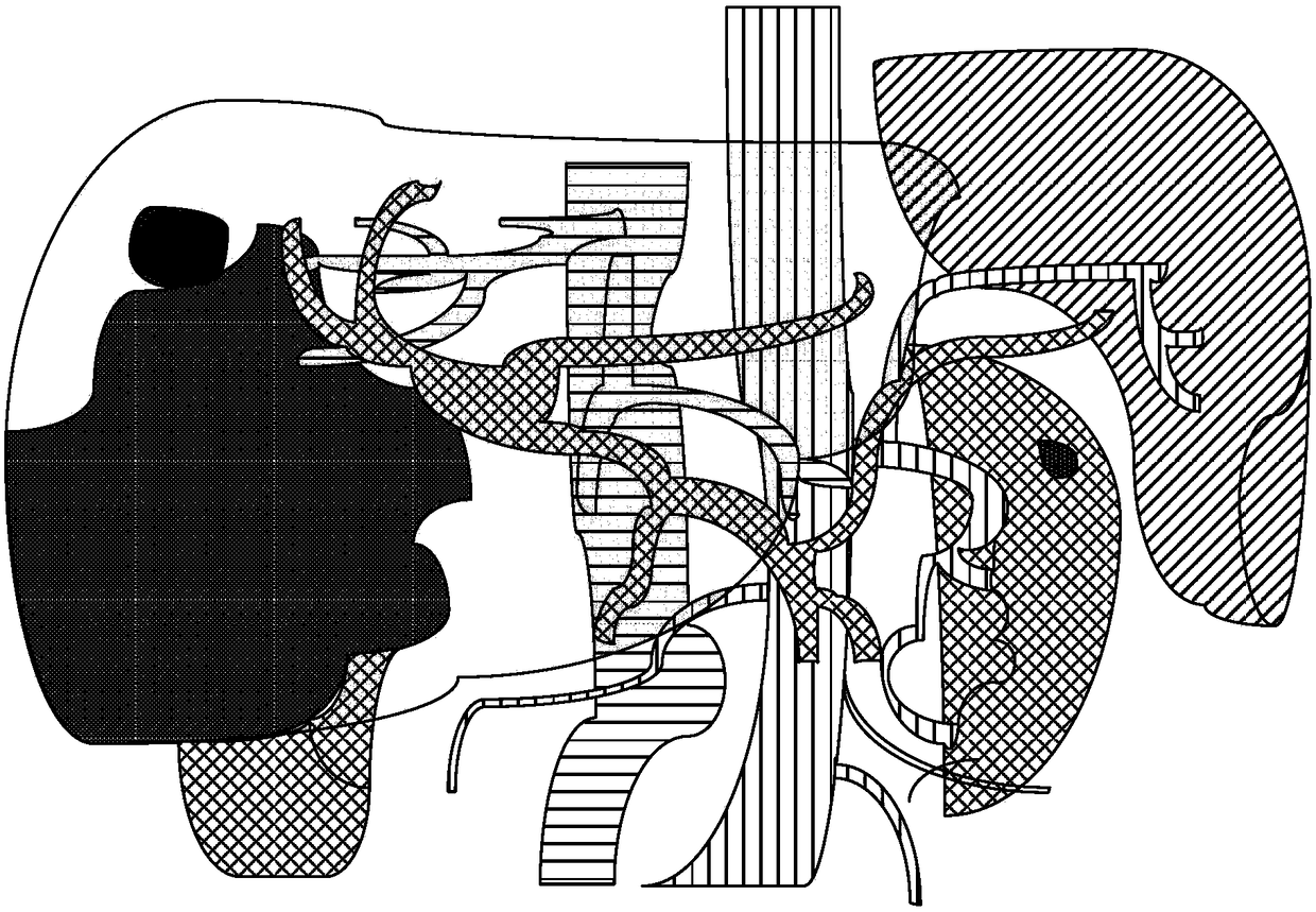 Three-dimensional virtual organ volume calculation method, device, storage medium and equipment