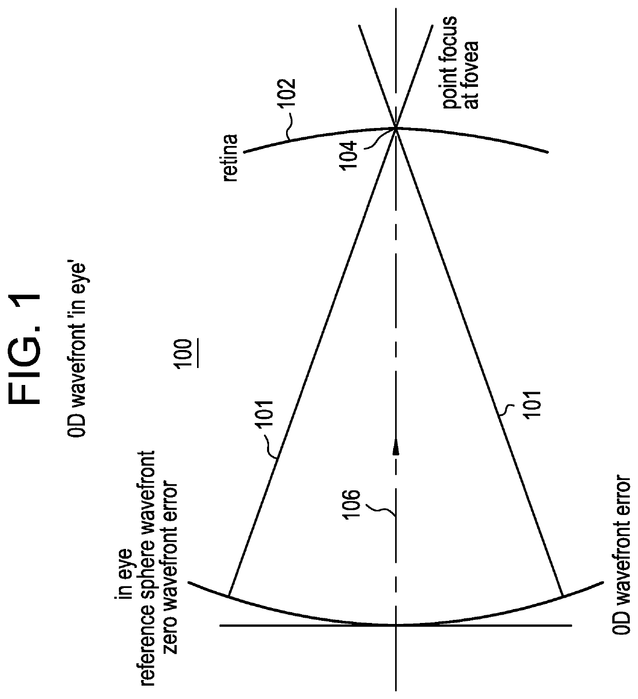 Ophthalmic lens comprising lenslets for preventing and/or slowing myopia progression