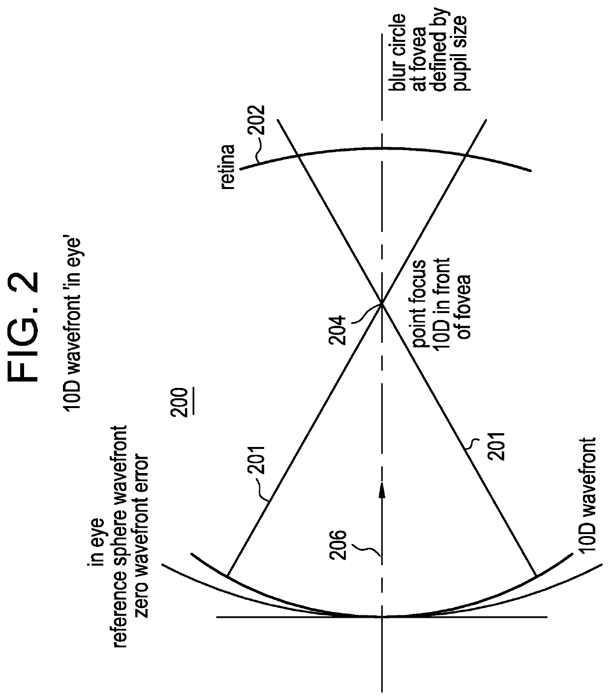 Ophthalmic lens comprising lenslets for preventing and/or slowing myopia progression