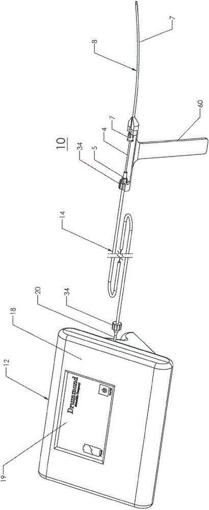 Method and apparatus for controlling in vitro fertilization