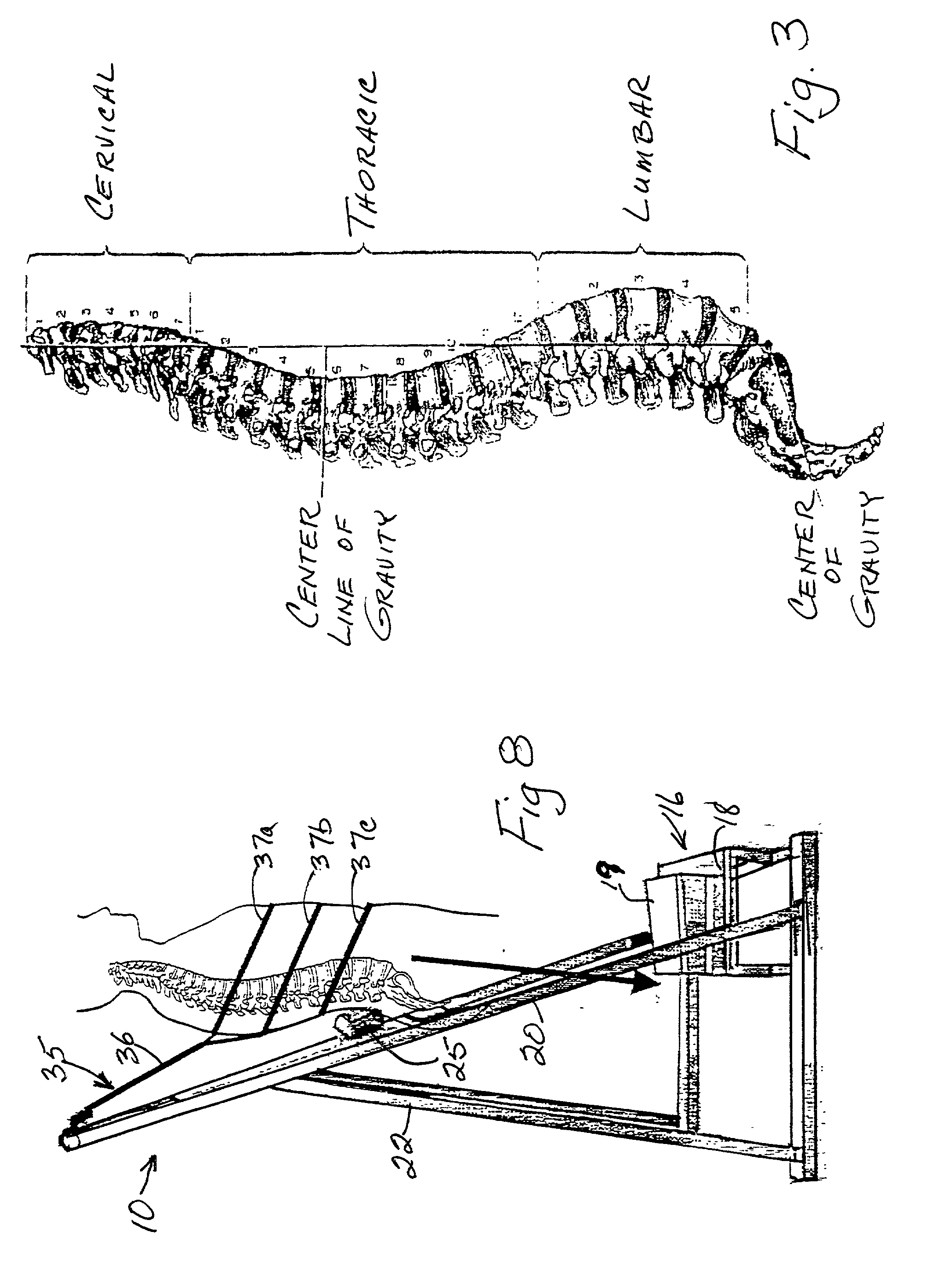 Vertical traction assembly and method