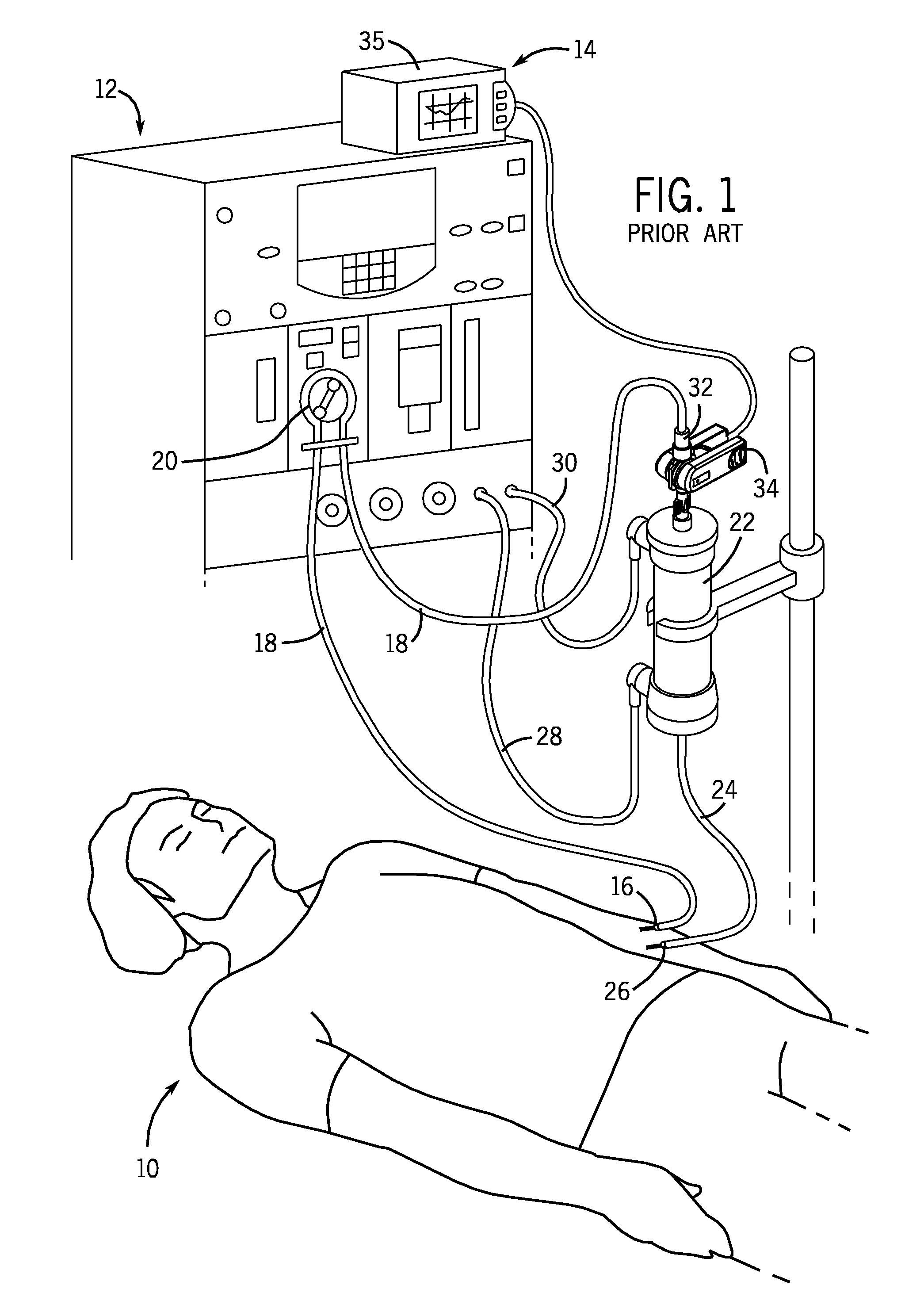 Sensor clip assembly for an optical monitoring system