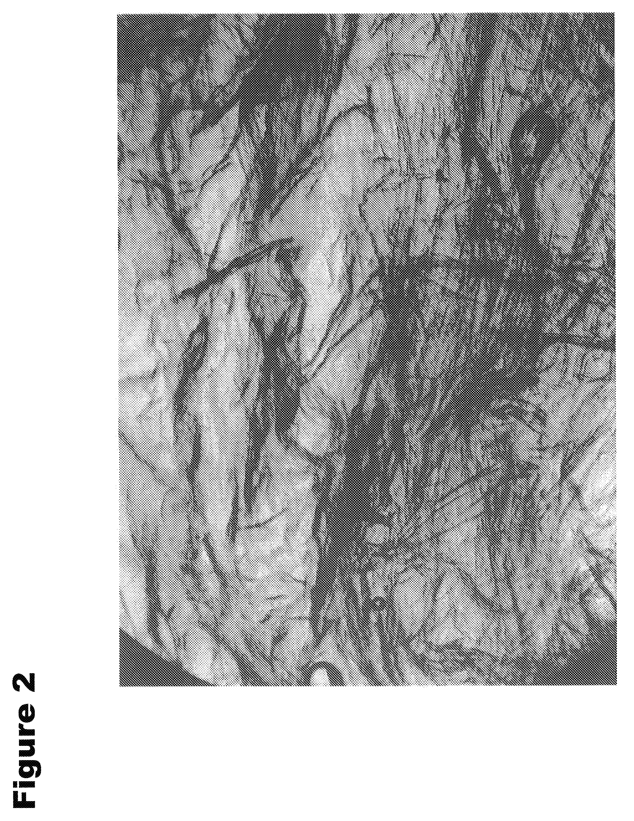 Process for Producing Colored Structured Plant Protein Products