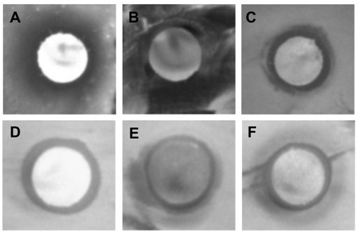 Screening method of leuconostoc mesenteroides and application of leuconostoc mesenteroides in preparation of aquatic product bacteriostatic agent