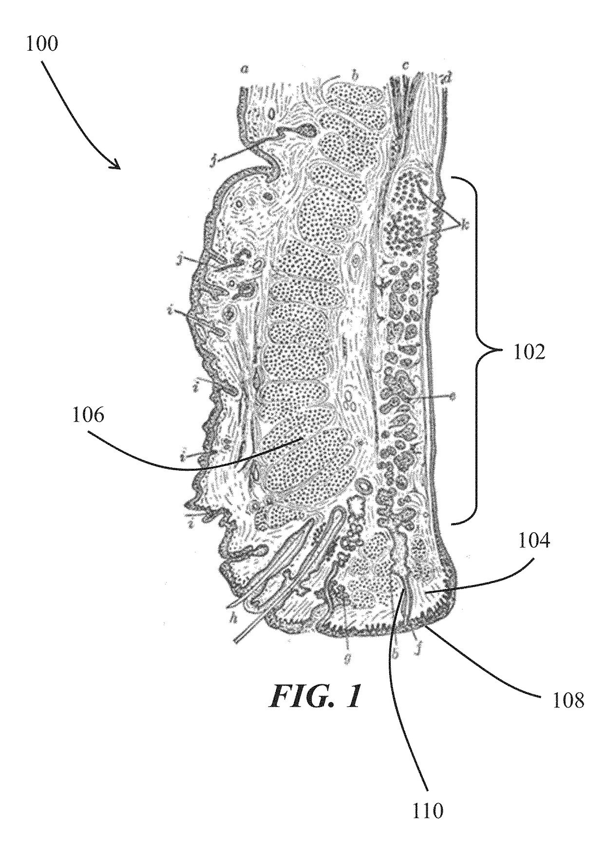 Intranasal stimulation for treatment of meibomian gland disease and blepharitis