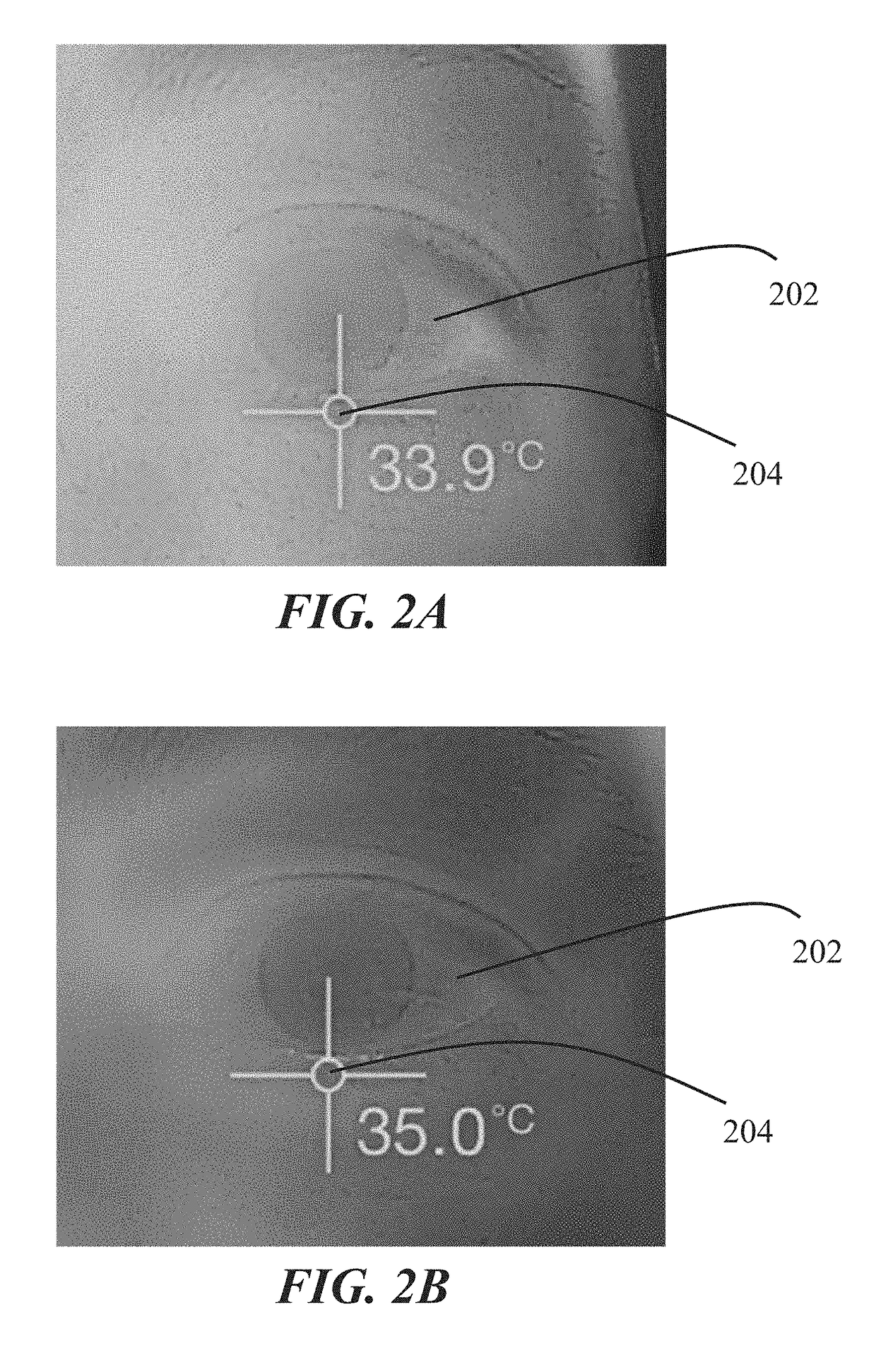 Intranasal stimulation for treatment of meibomian gland disease and blepharitis