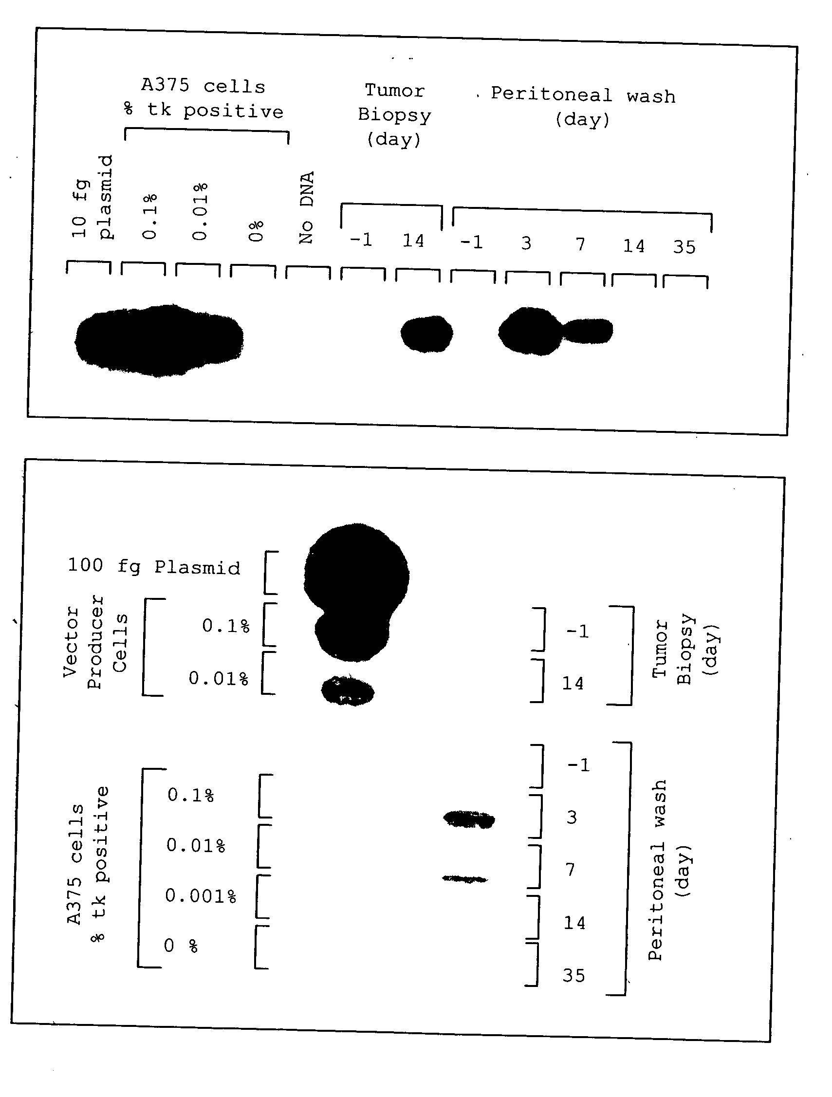 Method for tumor treatment using infusion of xenogeneic cells to induce hyperacute rejection and innocent bystander effect