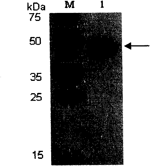 Method for producing American cockroach allergen protein Pera 9 in baculovirus-insect expression system