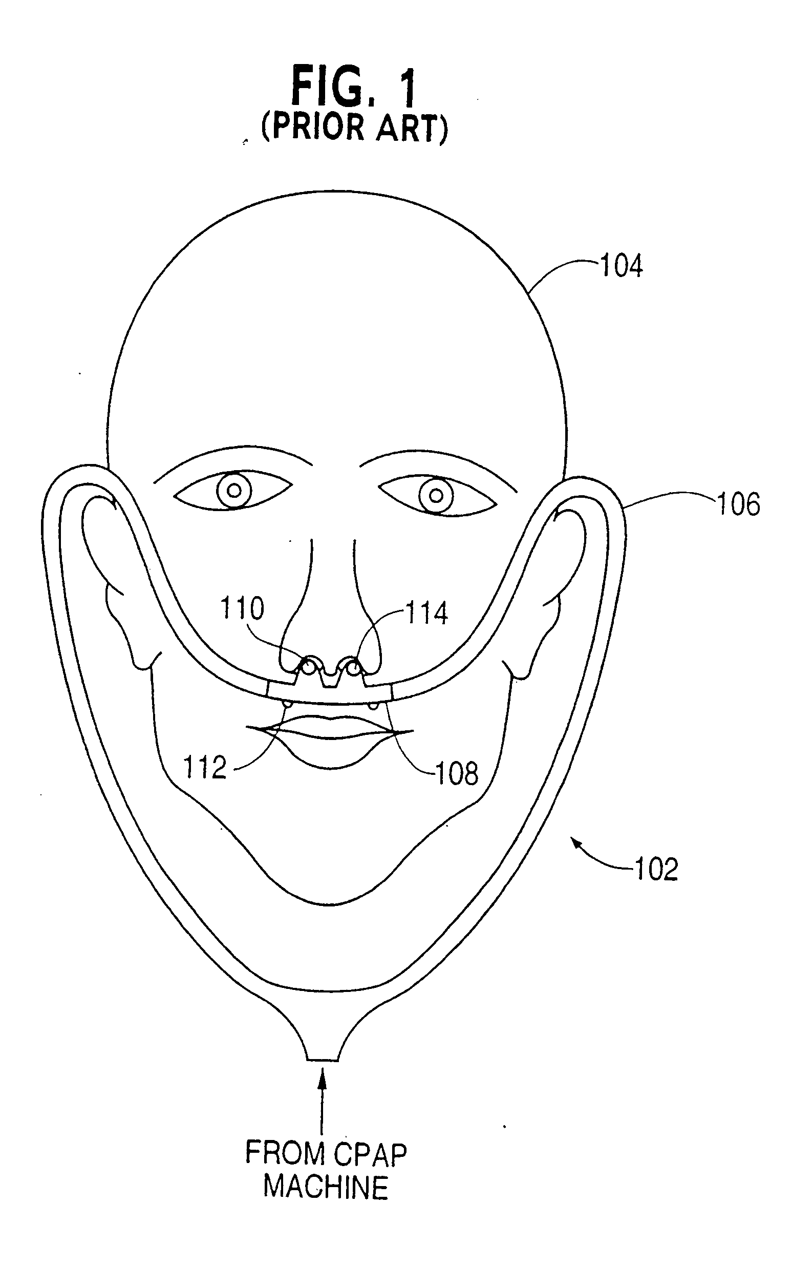 Nasal gas delivery system and method for use thereof