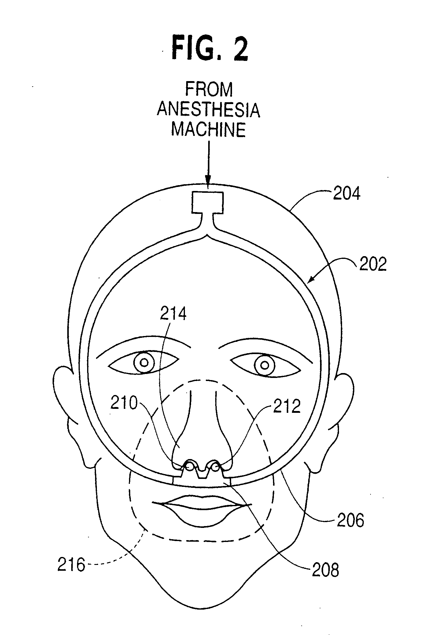 Nasal gas delivery system and method for use thereof