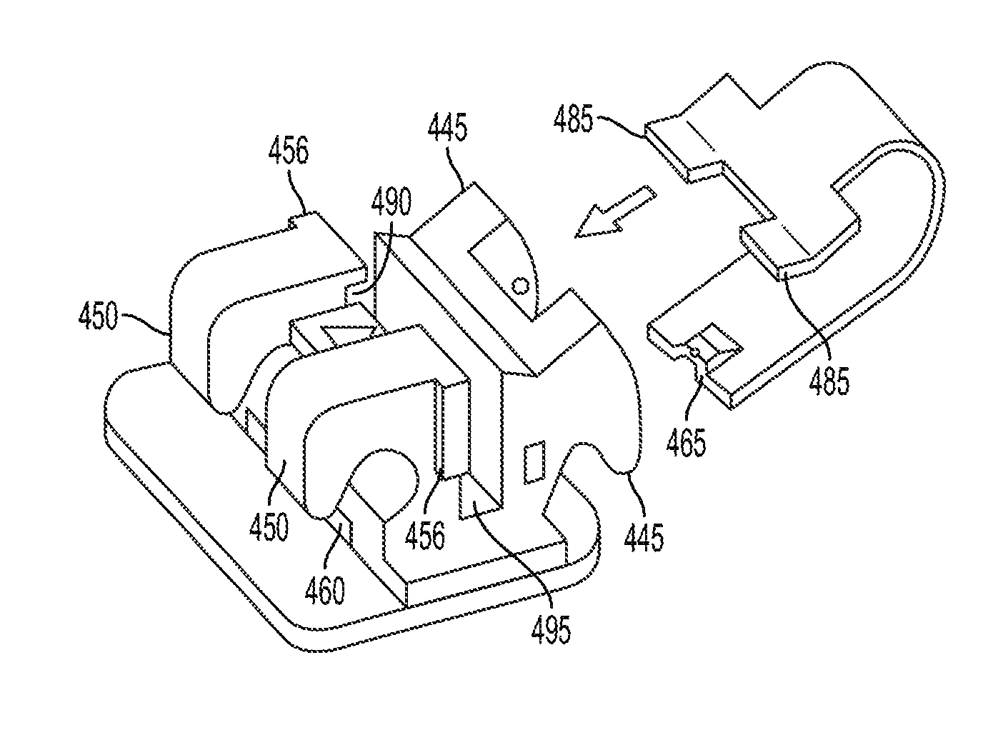 Biocompatible self-ligating brackets