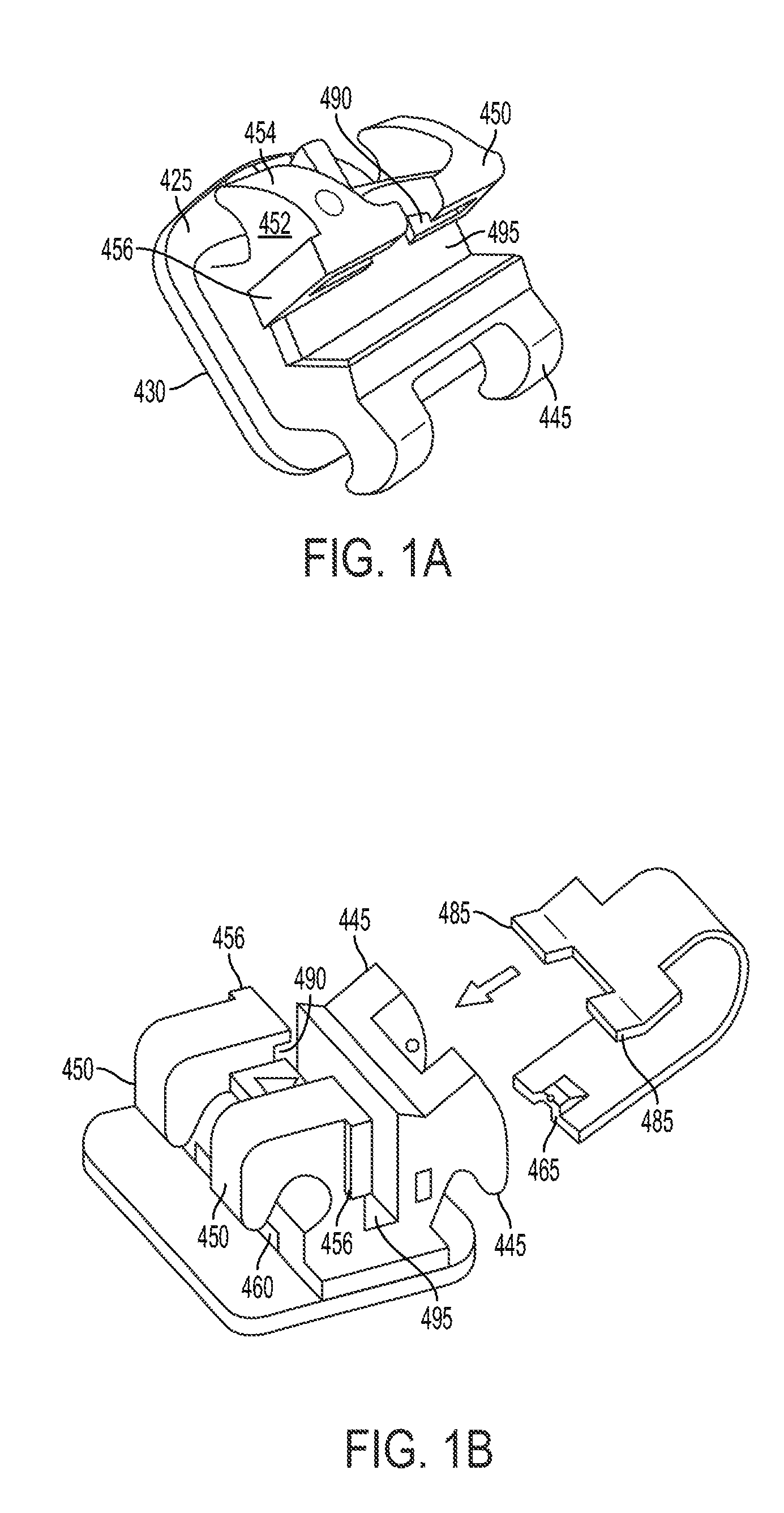 Biocompatible self-ligating brackets