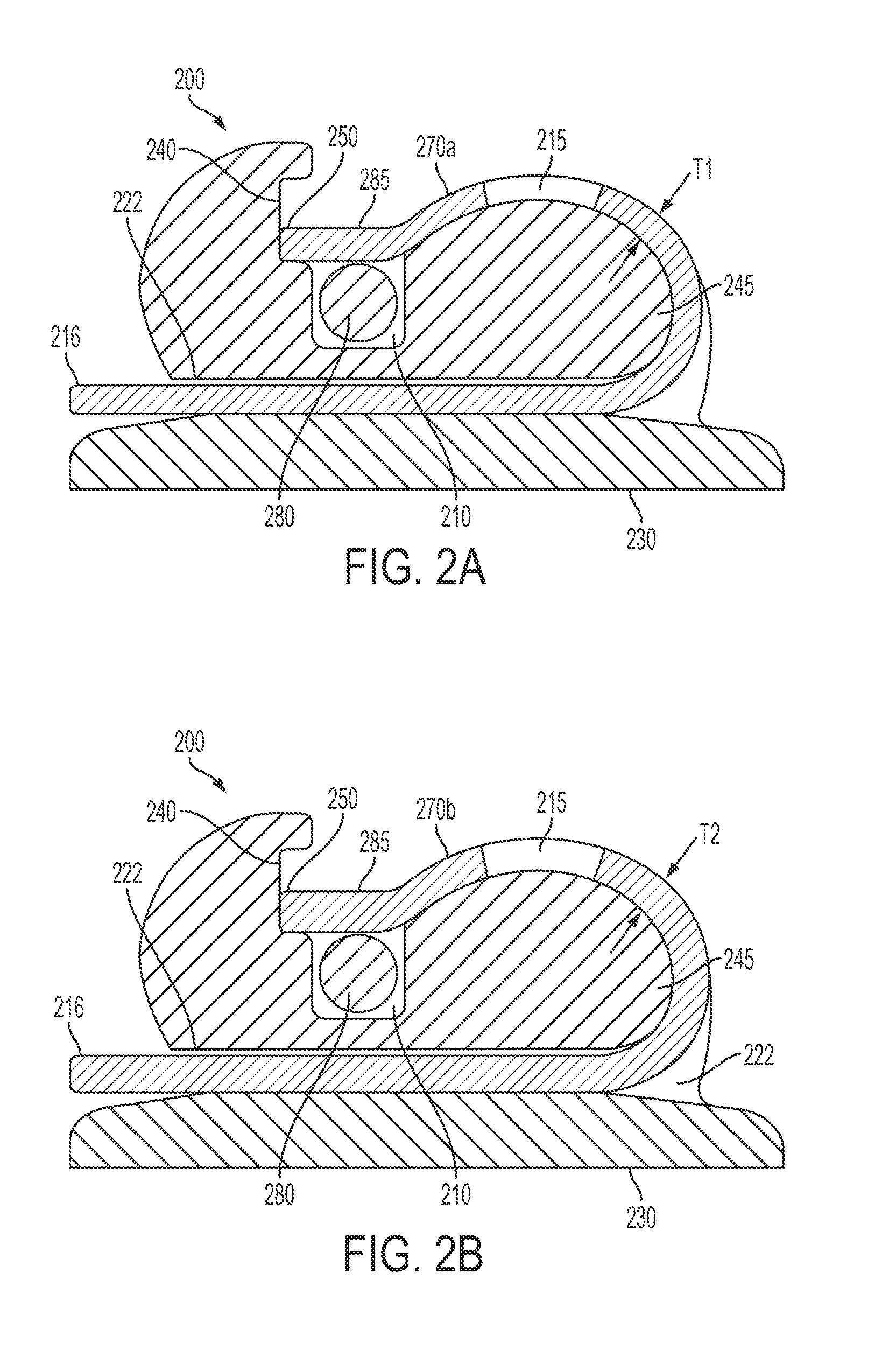 Biocompatible self-ligating brackets